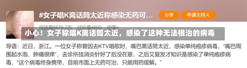 小心！女子称唱K离话筒太近，感染了这种无法根治的病毒