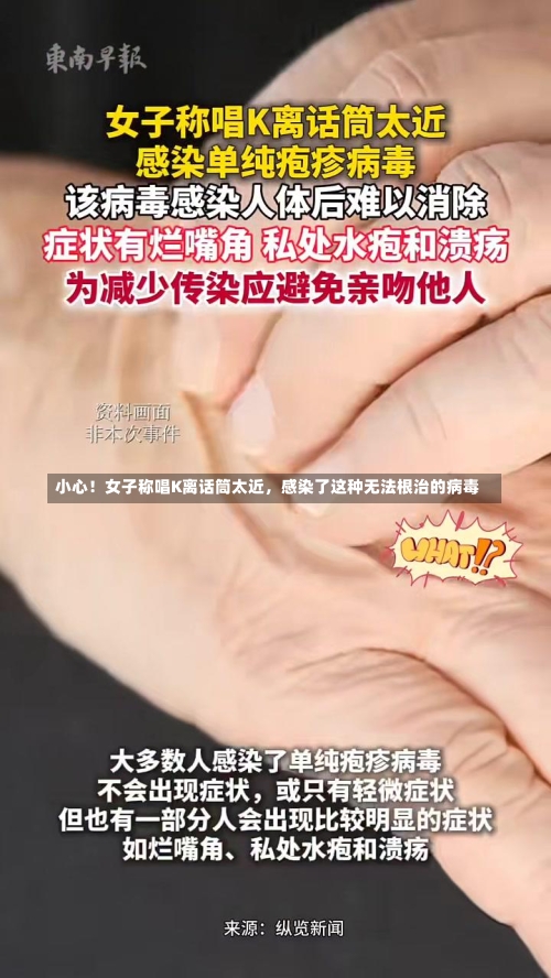 小心！女子称唱K离话筒太近，感染了这种无法根治的病毒